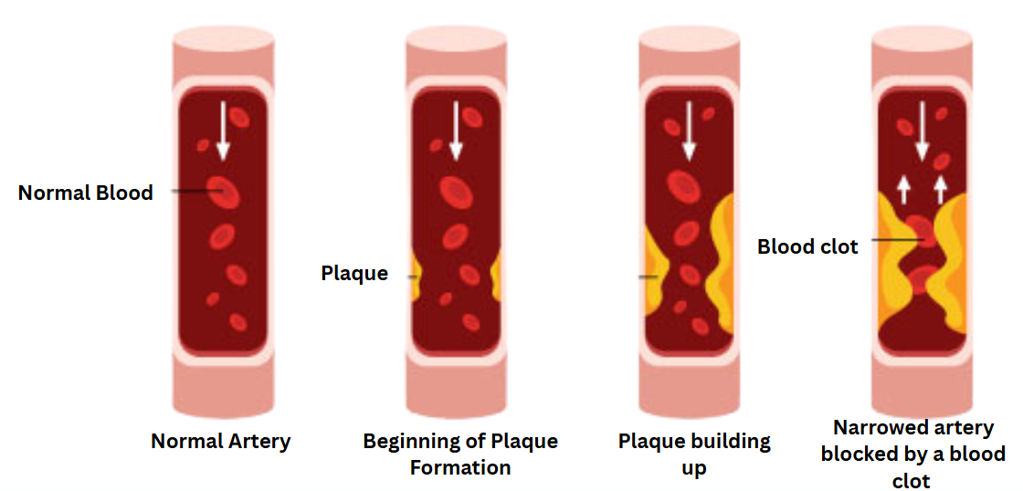 Blood Flow to the Spine