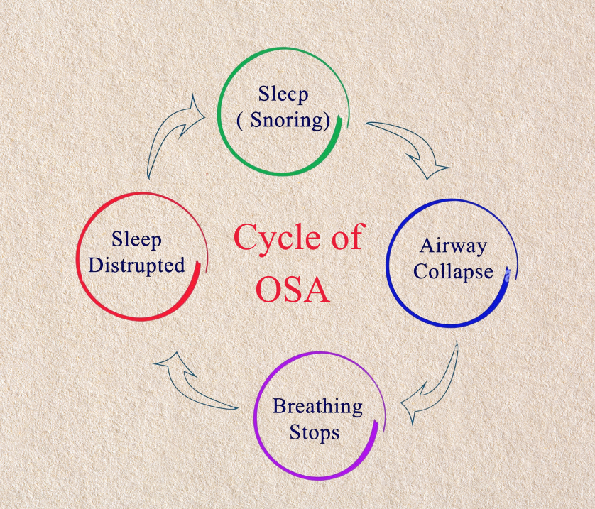 Cycle of OSA