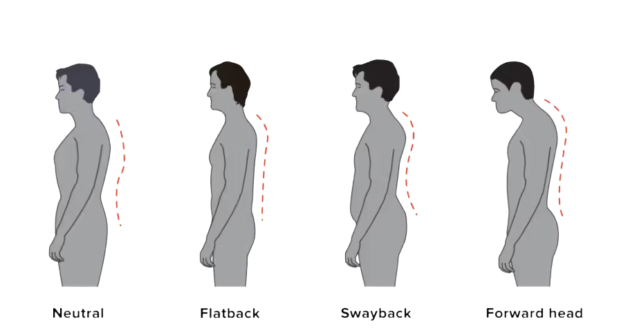 Postural and Structural Changes