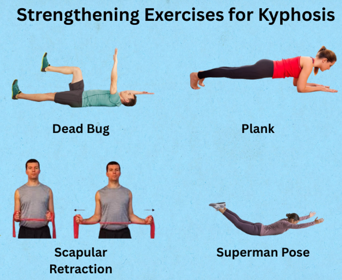 Strengthening Exercises