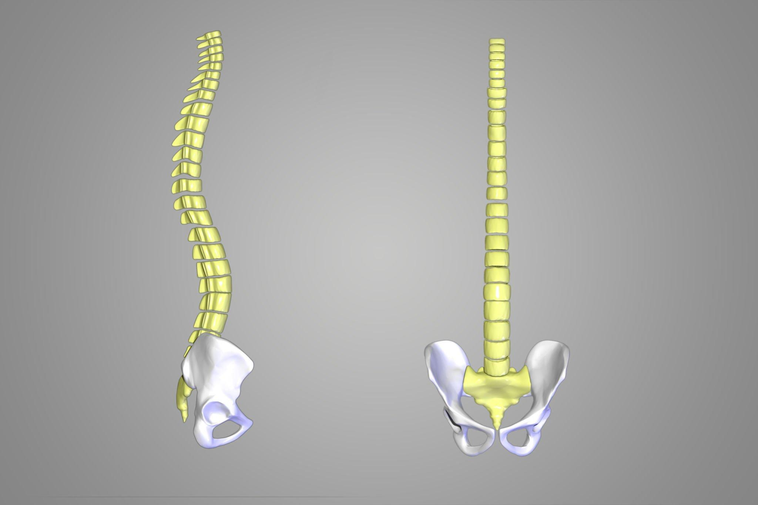 Spine Alignment Before and After - Dr. Mahmood Ahmad