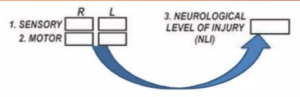 Asia (American Spinal Injury Association) Chart - Dr Mahmood