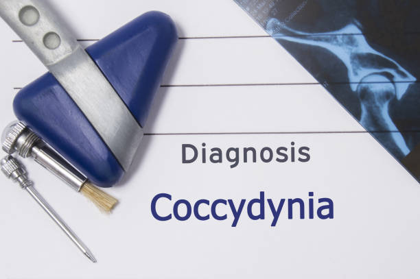 Coccydynia or Tail bone pain (Causes & Physical Therapy Management)