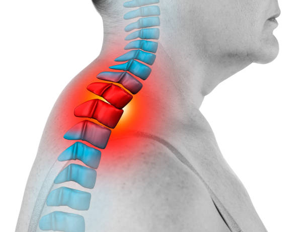 Upper Cervical Spine Anatomy