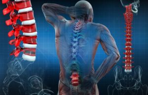 Understanding the Symptoms of Thoracic Spinal Stenosis