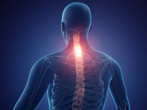 Neck Pain