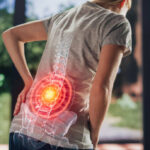 Myths About Back Pain You Should Stop Believing